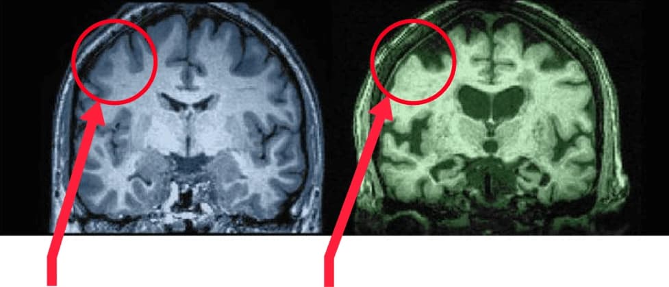 Brain comparison infographic #1