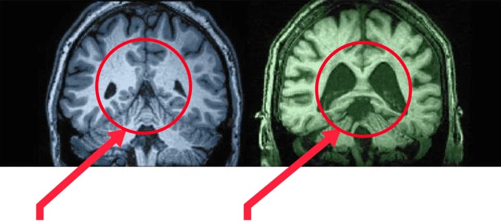 Brain comparison infographic #2
