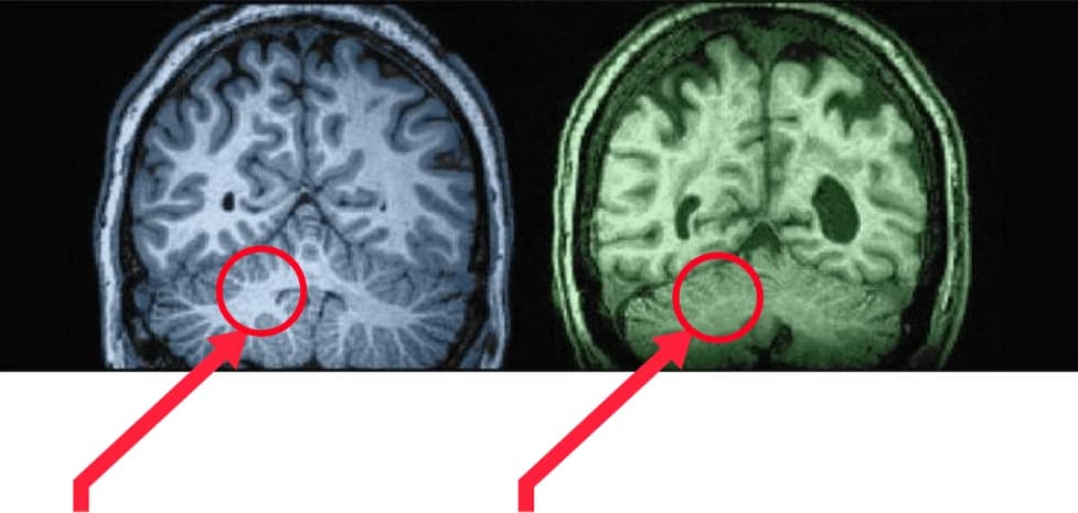 Brain comparison infographic #3