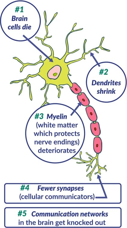 Your Incredible Shrinking Brain