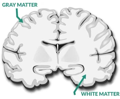 White matter vs. Gray Matter