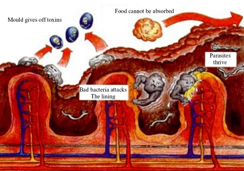 Bad bacteria attacks The lining
