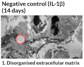 Negative control (IL-13)(14 days)