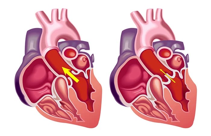 Symptoms and consequences of congestive heart