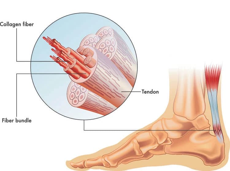 Tendon foot