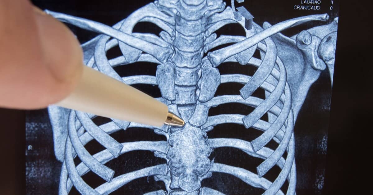 How to Keep This Important Part of Your Immune System from Pooping Out on You about Colon Ultra Cleanse