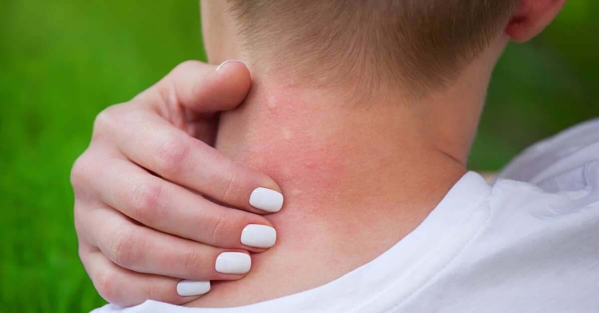 Think Twice Before You Scratch that Itch about My Sleep Miracle