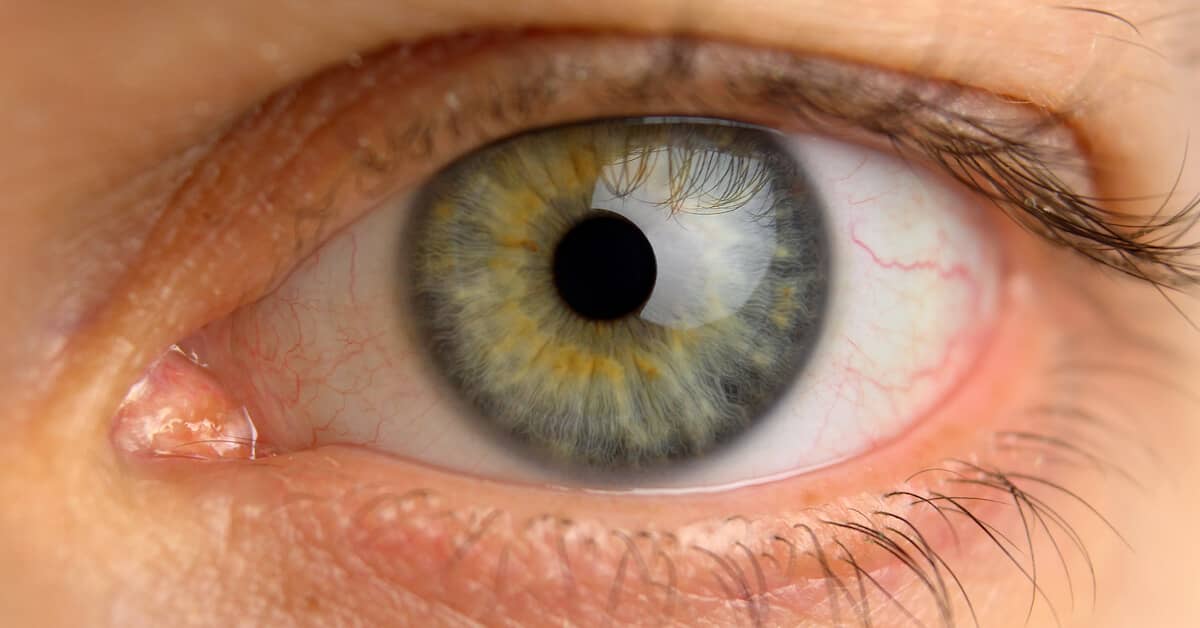 When Your Eyes Can Reveal If You Have Heart Disease… about Eye Vitality Plus