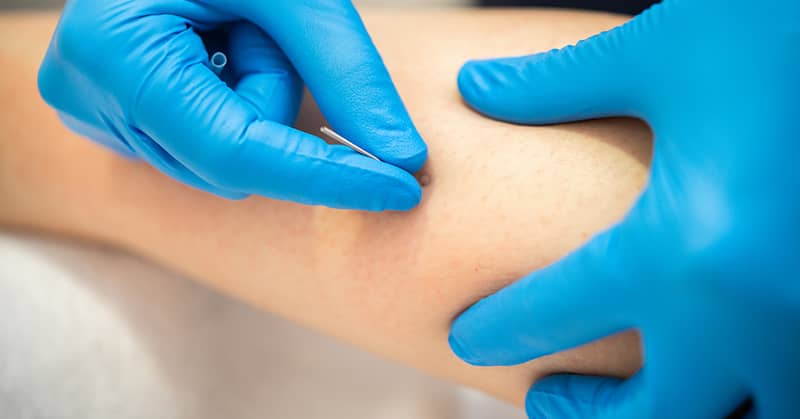 Natural Pain Relief That’s Fast And Lasts about Bone & Muscle Defense